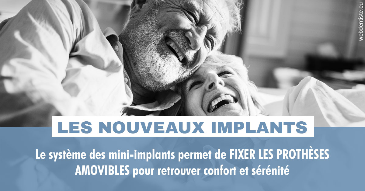 https://www.dr-michel-mahiet.fr/Les nouveaux implants 2