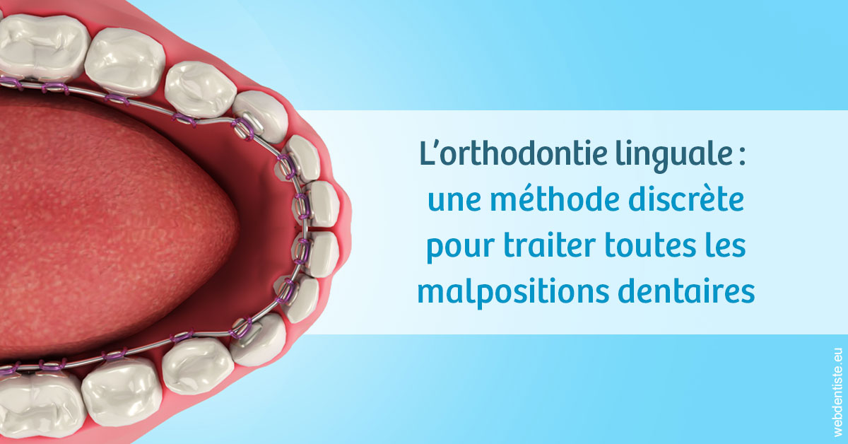 https://www.dr-michel-mahiet.fr/L'orthodontie linguale 1