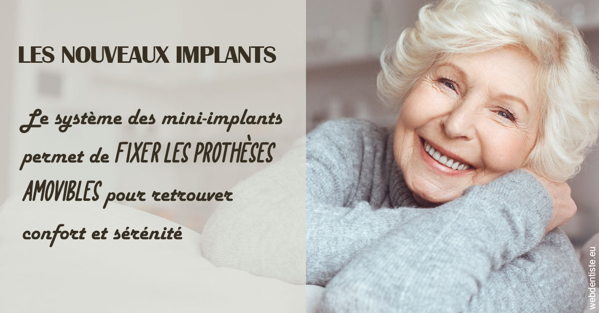 https://www.dr-michel-mahiet.fr/Les nouveaux implants 1