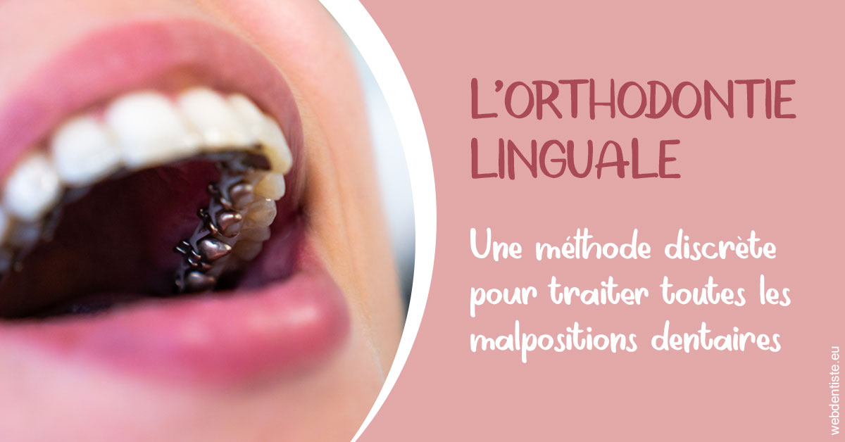 https://www.dr-michel-mahiet.fr/L'orthodontie linguale 2