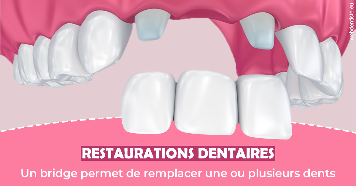 https://www.dr-michel-mahiet.fr/Bridge remplacer dents 2