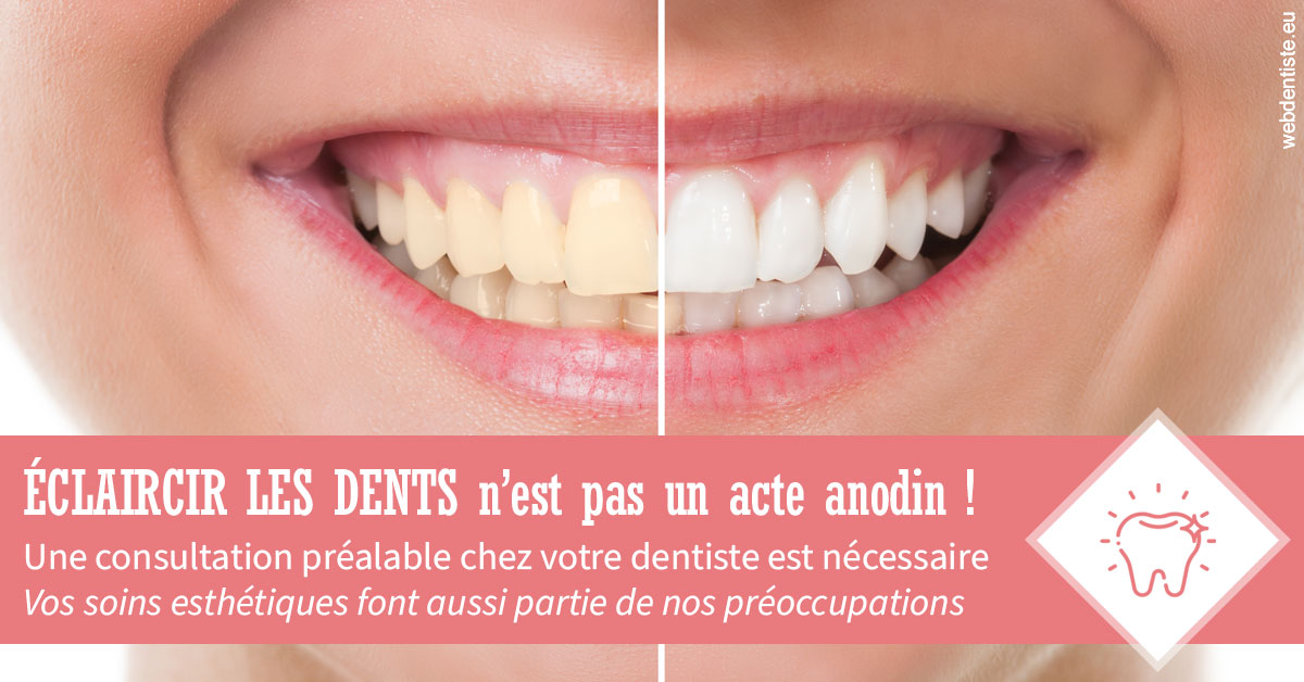 https://www.dr-michel-mahiet.fr/Eclaircir les dents 1