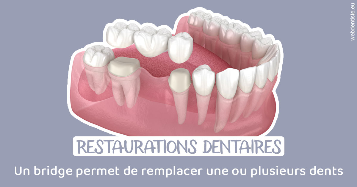 https://www.dr-michel-mahiet.fr/Bridge remplacer dents 1