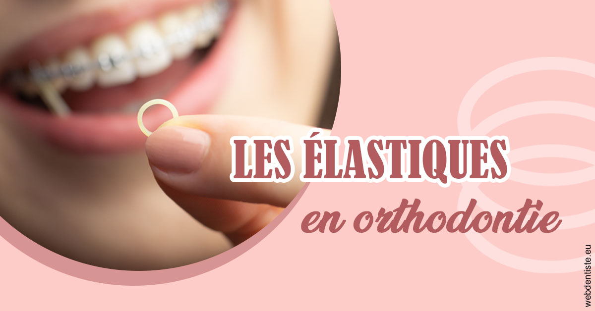https://www.dr-michel-mahiet.fr/Elastiques orthodontie 1