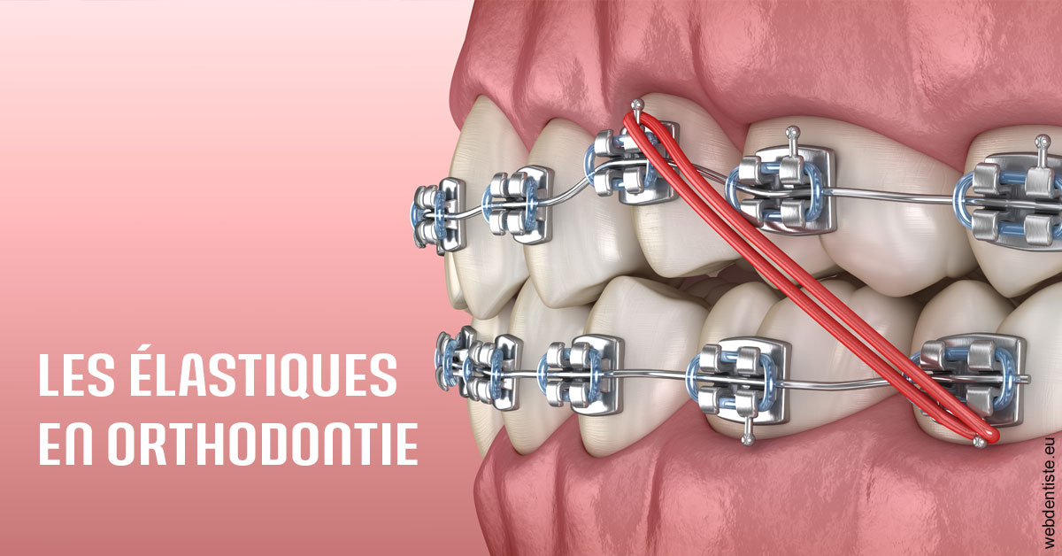https://www.dr-michel-mahiet.fr/Elastiques orthodontie 2