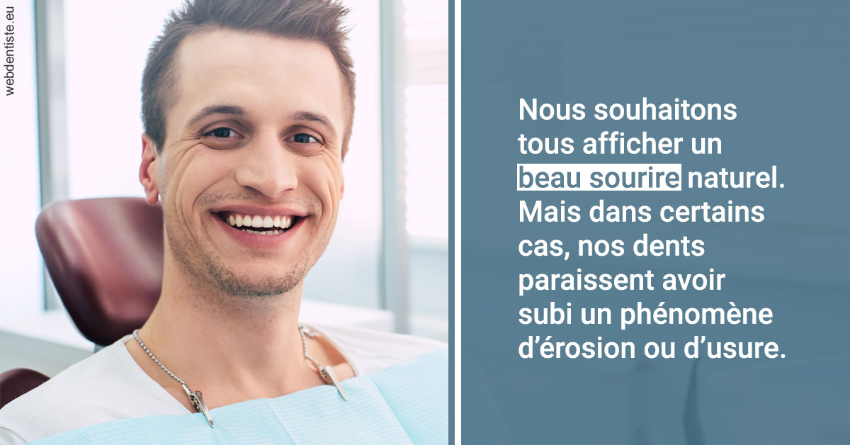 https://www.dr-michel-mahiet.fr/Érosion et usure dentaire