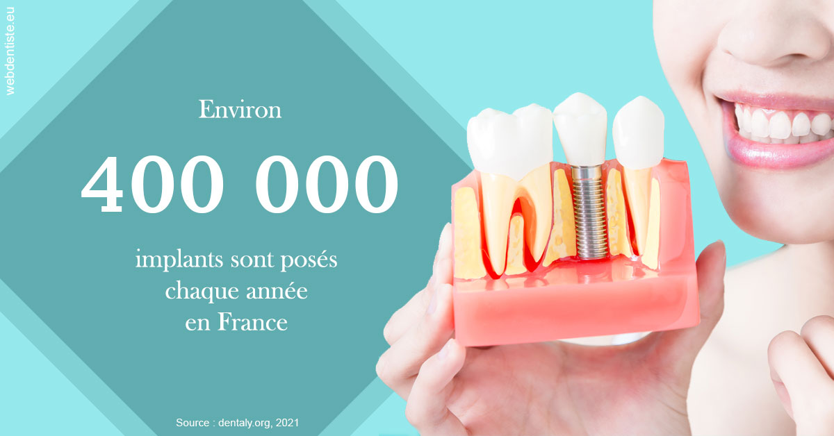 https://www.dr-michel-mahiet.fr/Pose d'implants en France 2