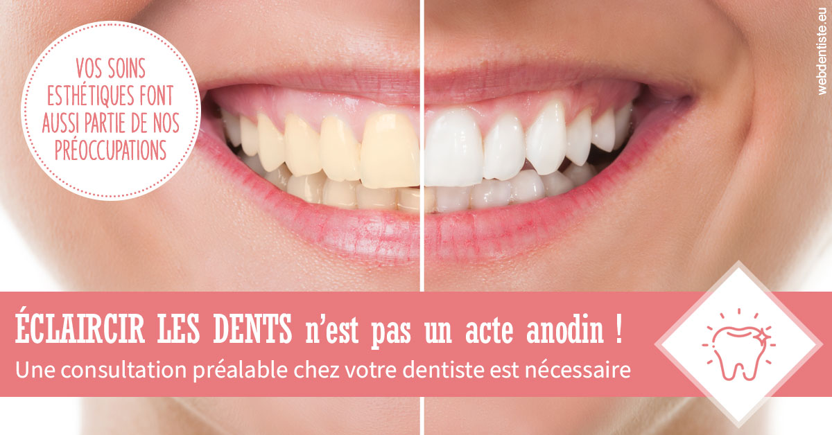 https://www.dr-michel-mahiet.fr/Eclaircir les dents 1