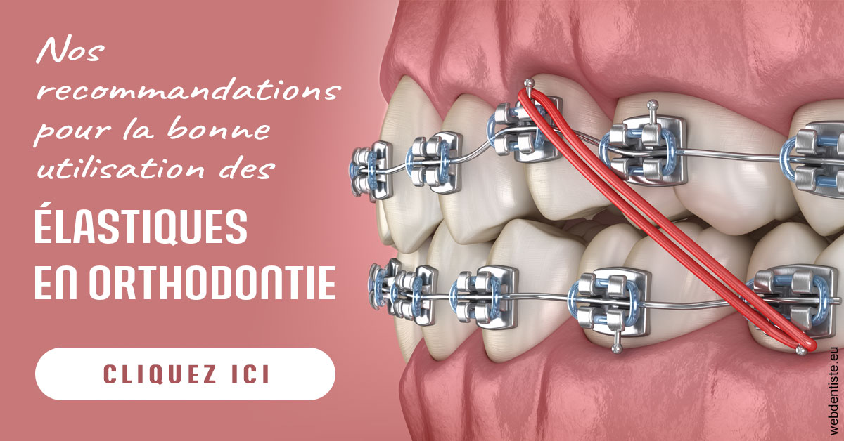 https://www.dr-michel-mahiet.fr/Elastiques orthodontie 2